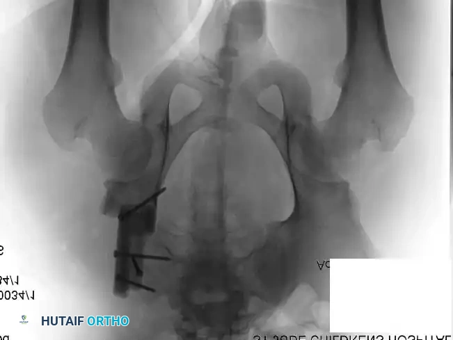 Hutaifortho's Orthopaedic Diagram