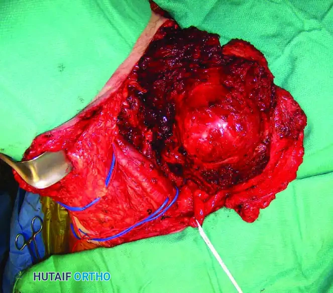 Hutaifortho's Orthopaedic Diagram