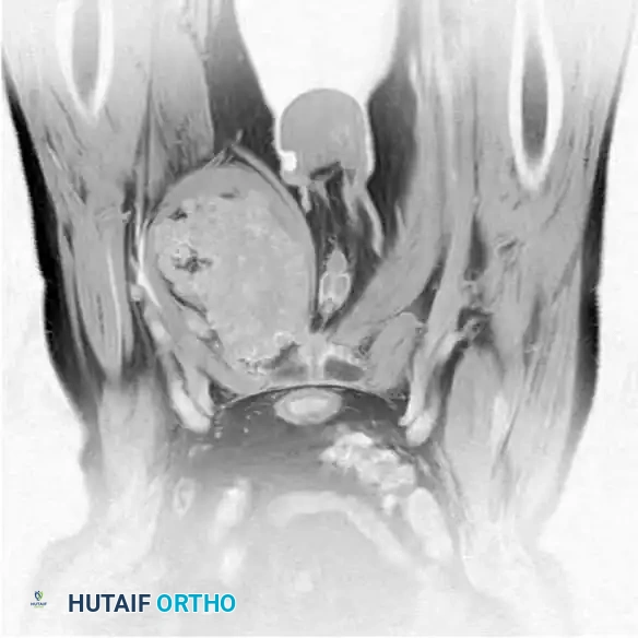 Hutaifortho's Orthopaedic Diagram