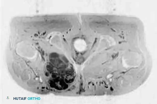 Hutaifortho's Orthopaedic Diagram