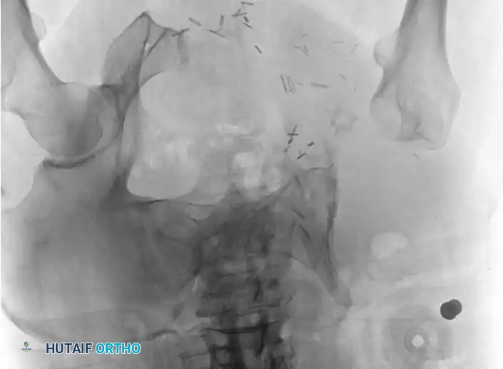 Hutaifortho's Orthopaedic Diagram