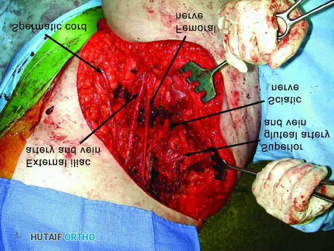 Hutaifortho's Orthopaedic Diagram