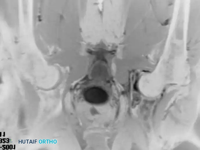 Hutaifortho's Orthopaedic Diagram