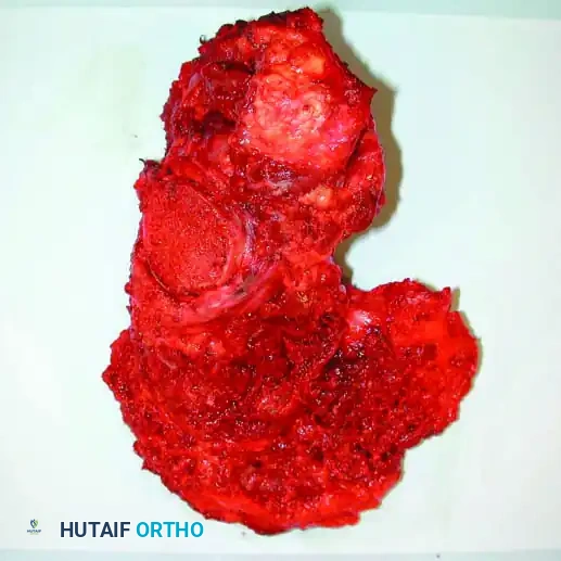 Hutaifortho's Orthopaedic Diagram