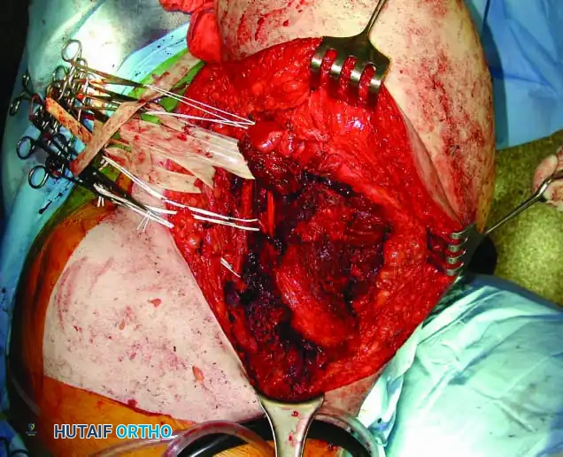 Hutaifortho's Orthopaedic Diagram