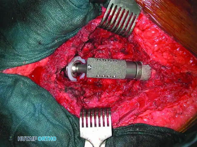 Hutaifortho's Orthopaedic Diagram