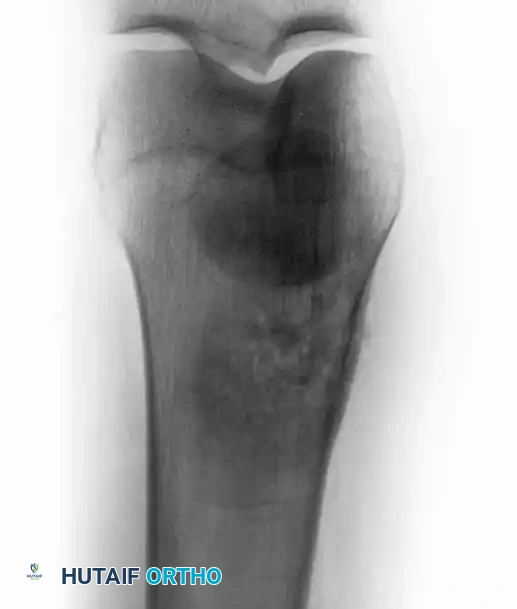 Hutaifortho's Orthopaedic Diagram