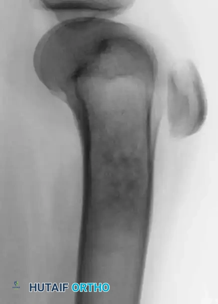 Hutaifortho's Orthopaedic Diagram