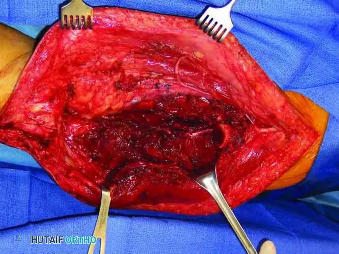 Hutaifortho's Orthopaedic Diagram