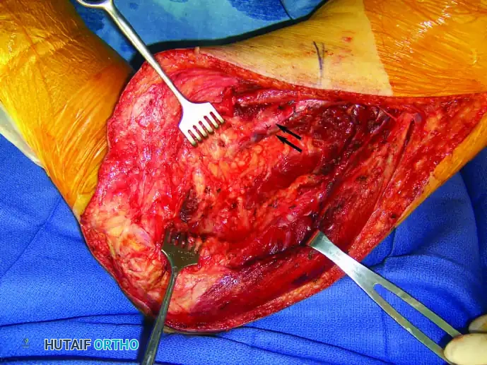 Hutaifortho's Orthopaedic Diagram