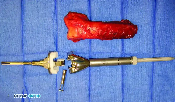 Hutaifortho's Orthopaedic Diagram