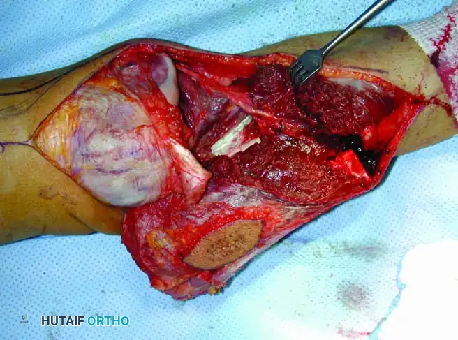 Hutaifortho's Orthopaedic Diagram