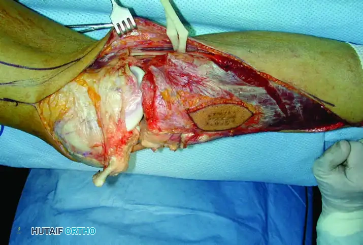 Hutaifortho's Orthopaedic Diagram