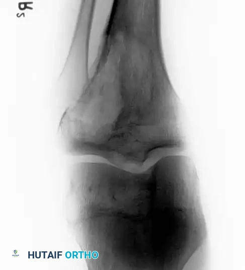 Hutaifortho's Orthopaedic Diagram