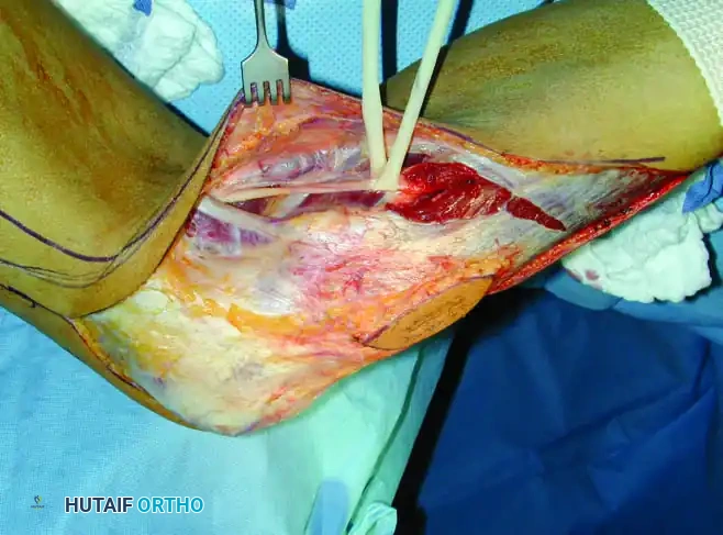 Hutaifortho's Orthopaedic Diagram