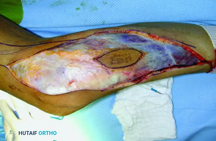 Hutaifortho's Orthopaedic Diagram