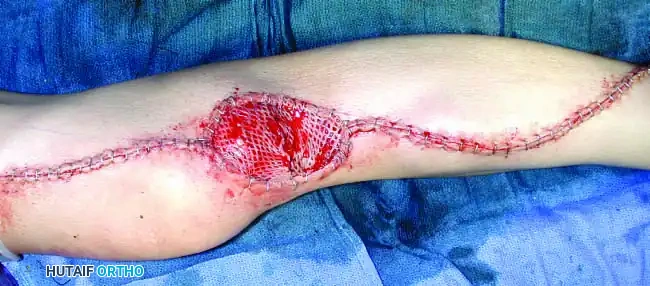 Hutaifortho's Orthopaedic Diagram