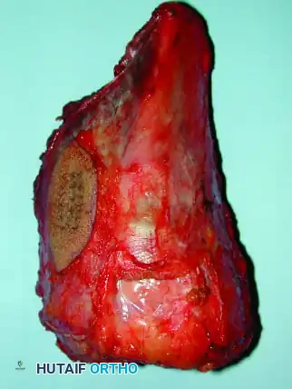 Hutaifortho's Orthopaedic Diagram