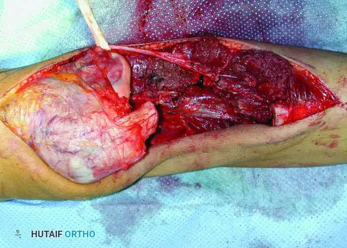 Hutaifortho's Orthopaedic Diagram
