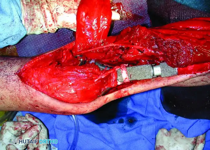 Hutaifortho's Orthopaedic Diagram