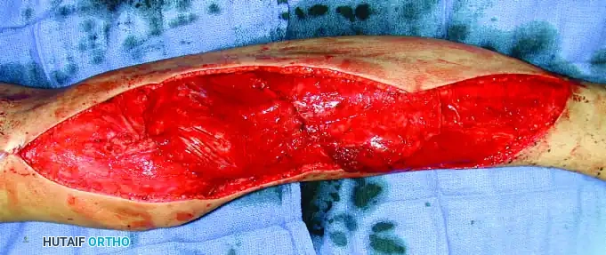 Hutaifortho's Orthopaedic Diagram