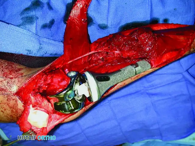 Hutaifortho's Orthopaedic Diagram