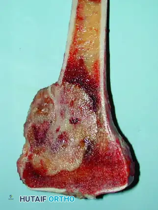 Hutaifortho's Orthopaedic Diagram