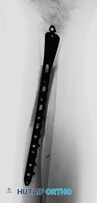 Hutaifortho's Orthopaedic Diagram