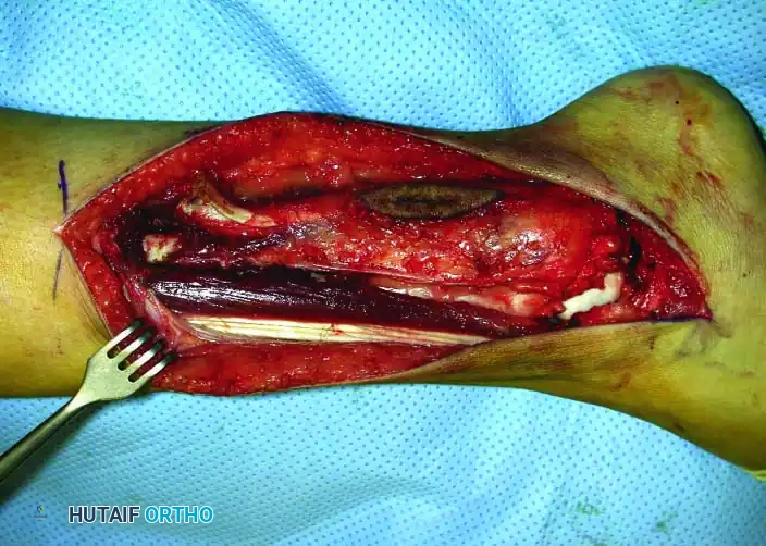 Hutaifortho's Orthopaedic Diagram