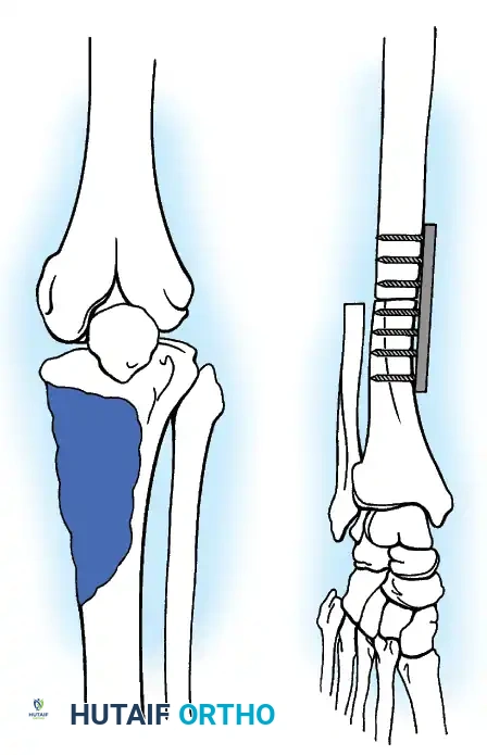 Hutaifortho's Orthopaedic Diagram
