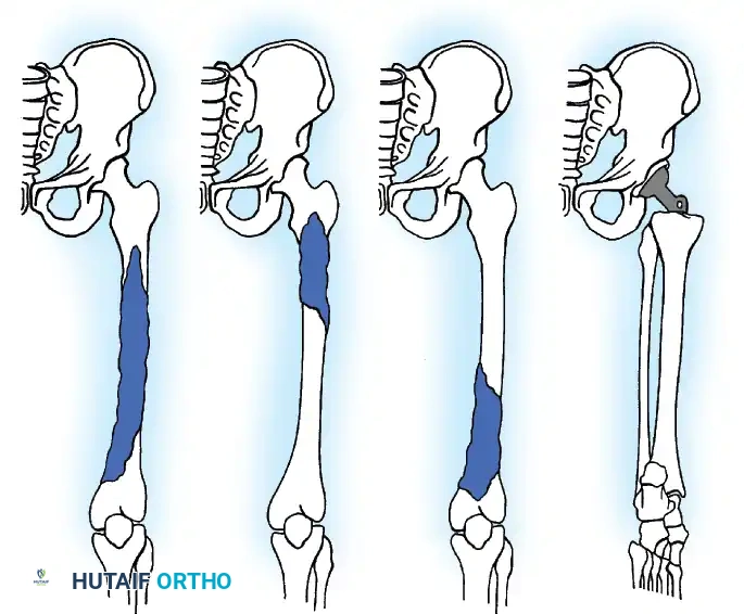 Hutaifortho's Orthopaedic Diagram