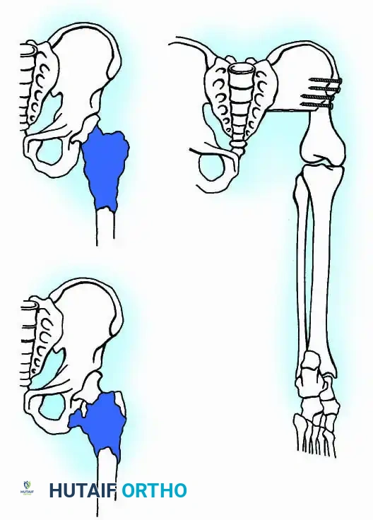Hutaifortho's Orthopaedic Diagram