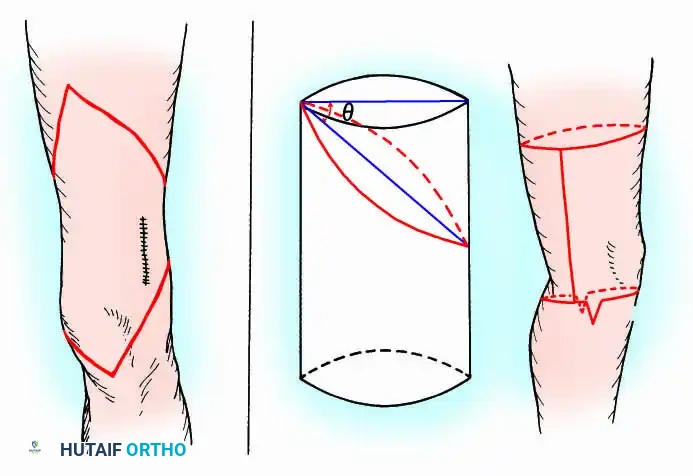 Hutaifortho's Orthopaedic Diagram