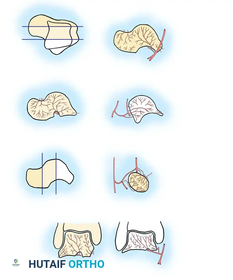 Dorsal view of the talus showing the areas covered by the following sections