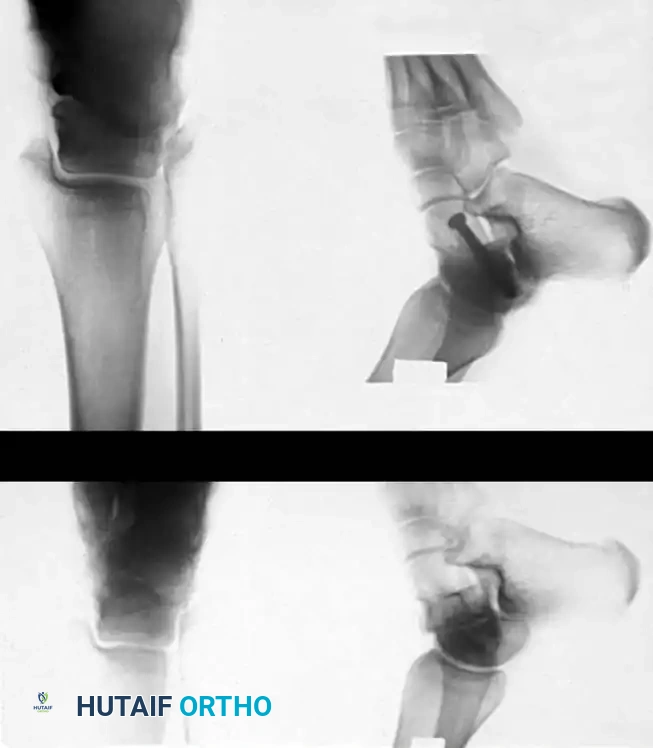 Radiographic positioning/Canale view