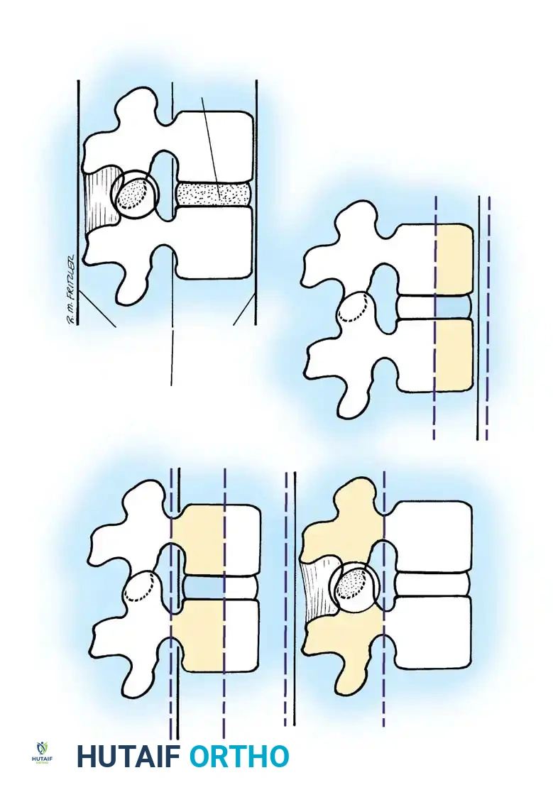 Denis Three-Column Classification