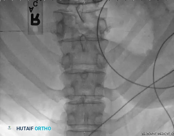 Intraoperative Fluoroscopy 1
