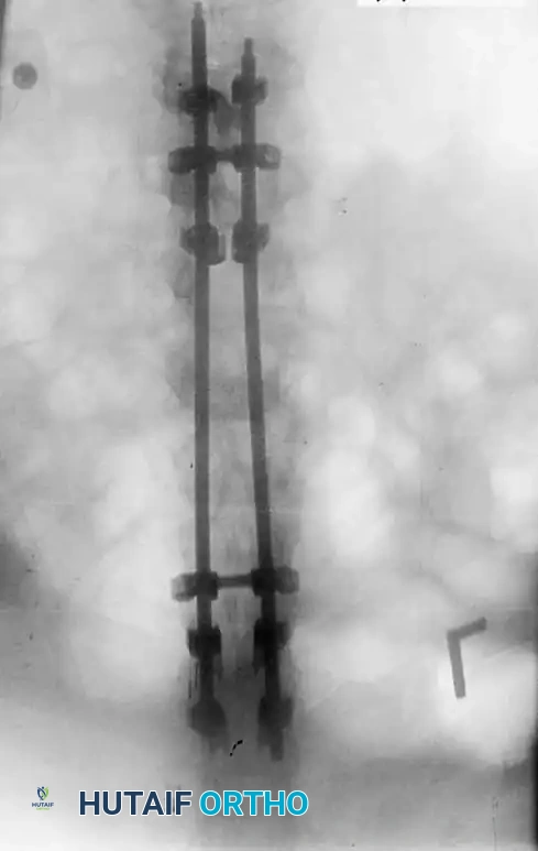 Intraoperative Fluoroscopy 5