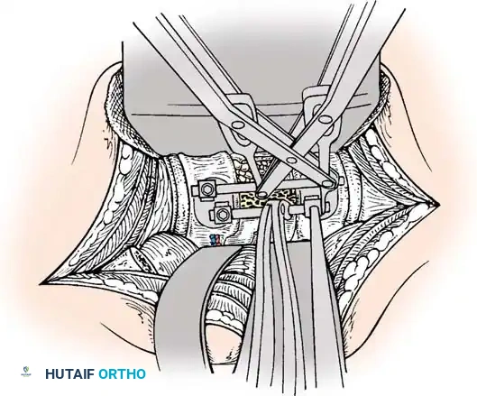 Instrumentation Diagram 2
