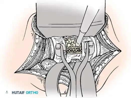 Instrumentation Diagram 3