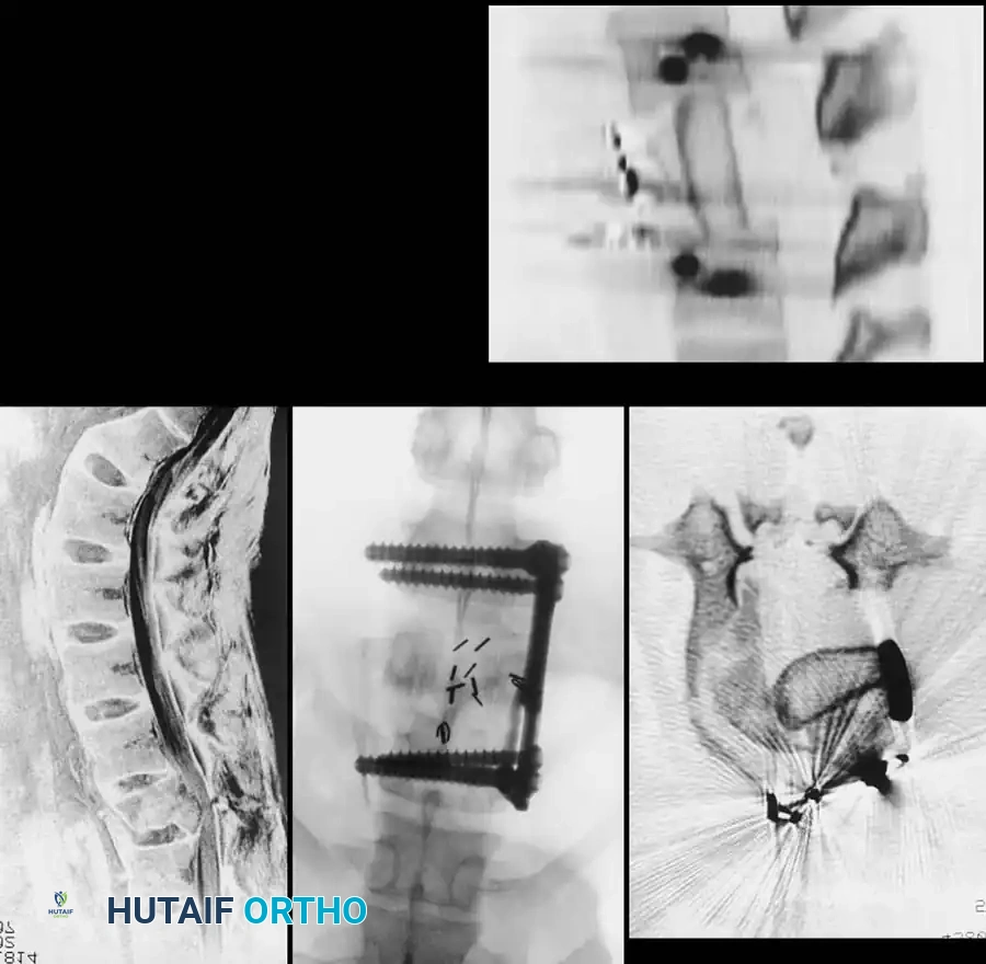 Hutaifortho's Orthopaedic Diagram