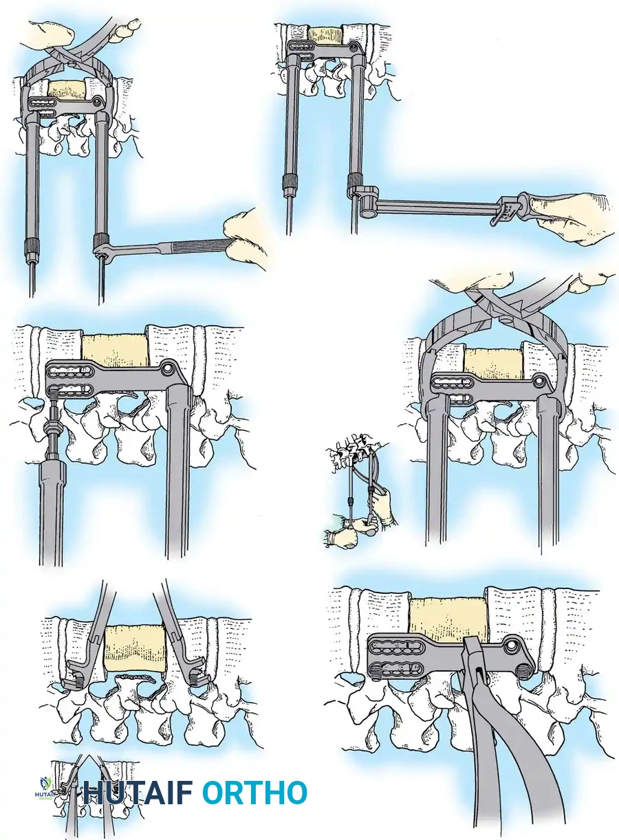 Hutaifortho's Orthopaedic Diagram