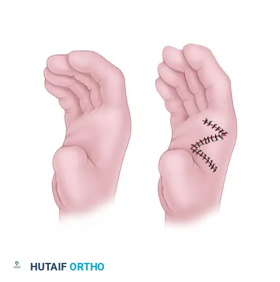تشريح وتكوين قصر الإبهام
