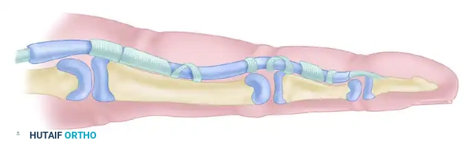 C3 A4 C2 A3 C1 A1 A2