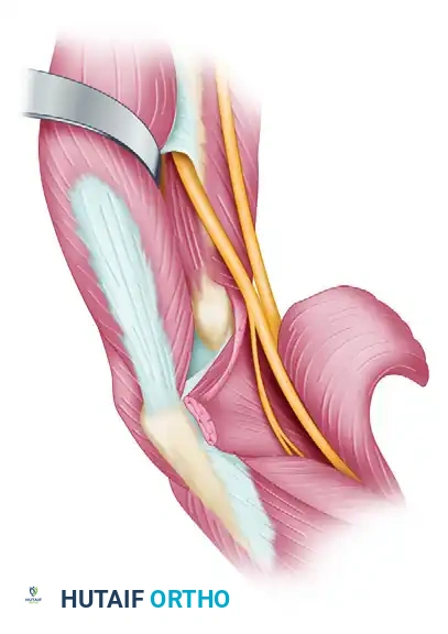 Origin, course, and distribution of median nerve