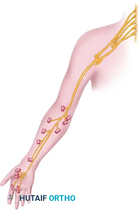 Dorsal sensory distribution of median nerve