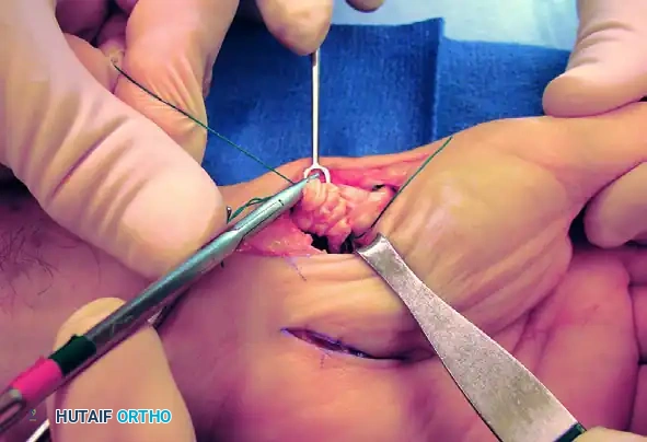 Hutaifortho's Orthopaedic Diagram
