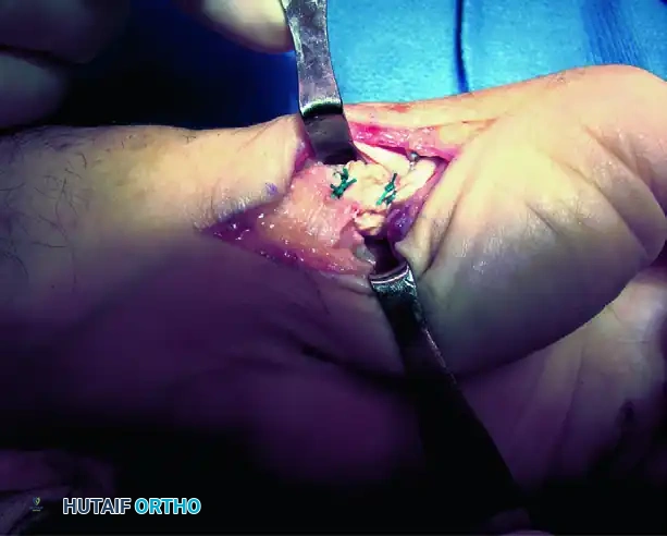 Hutaifortho's Orthopaedic Diagram