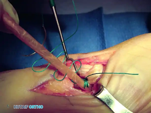 Hutaifortho's Orthopaedic Diagram