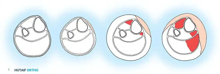 TRAUMA PRINCIPLES Surgical Diagram